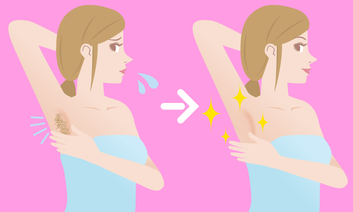 Electrolysis Hair Removal Female