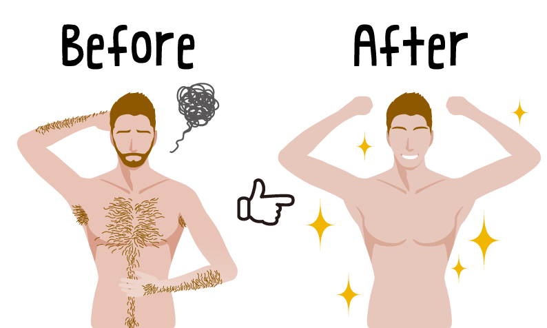 Electrolysis Hair Removal Male