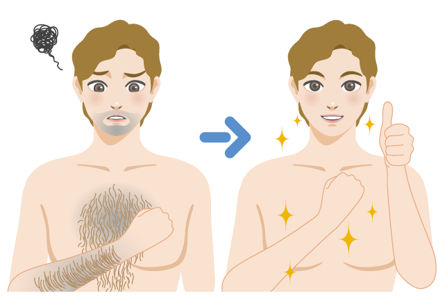 Electrolysis Hair Removal Trans